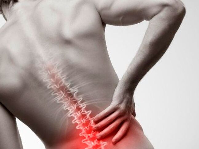 πόνος στη μέση λόγω οστεοχονδρωσίας