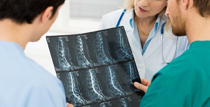 Ακτινογραφία της σπονδυλικής στήλης ως τρόπος διάγνωσης της οστεοχόνδρωσης