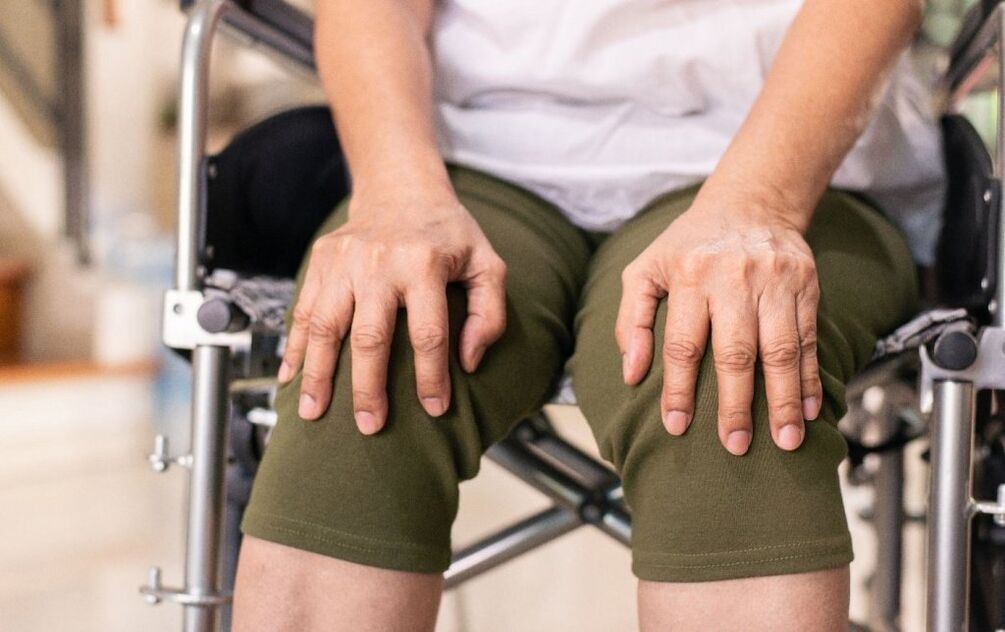 Ένας ασθενής με αρθρώσεις των αρθρώσεων του γόνατος
